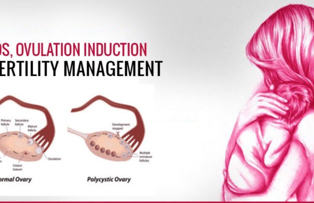 pcos and ovulation