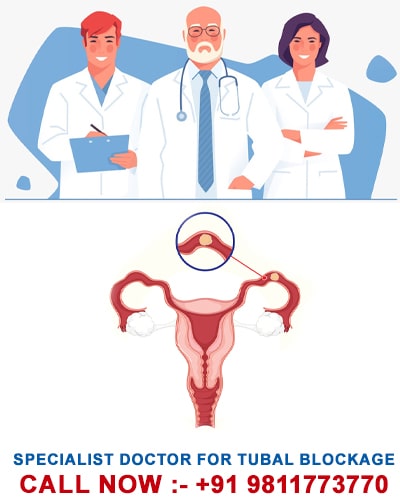 Doctor For Fallopian Tube Blockage, Fallopian Tube Blockage Treatment Doctor