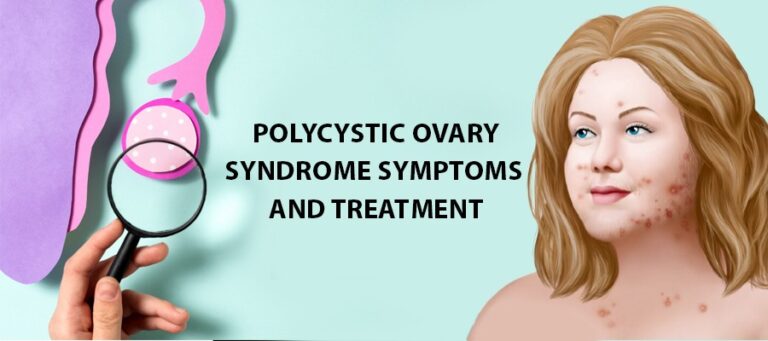 Polycystic Ovary Syndrome Symptoms, Causes, and Ayurvedic Treatment ...