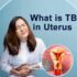 What is tb in uterus and symptoms of tb in uterus